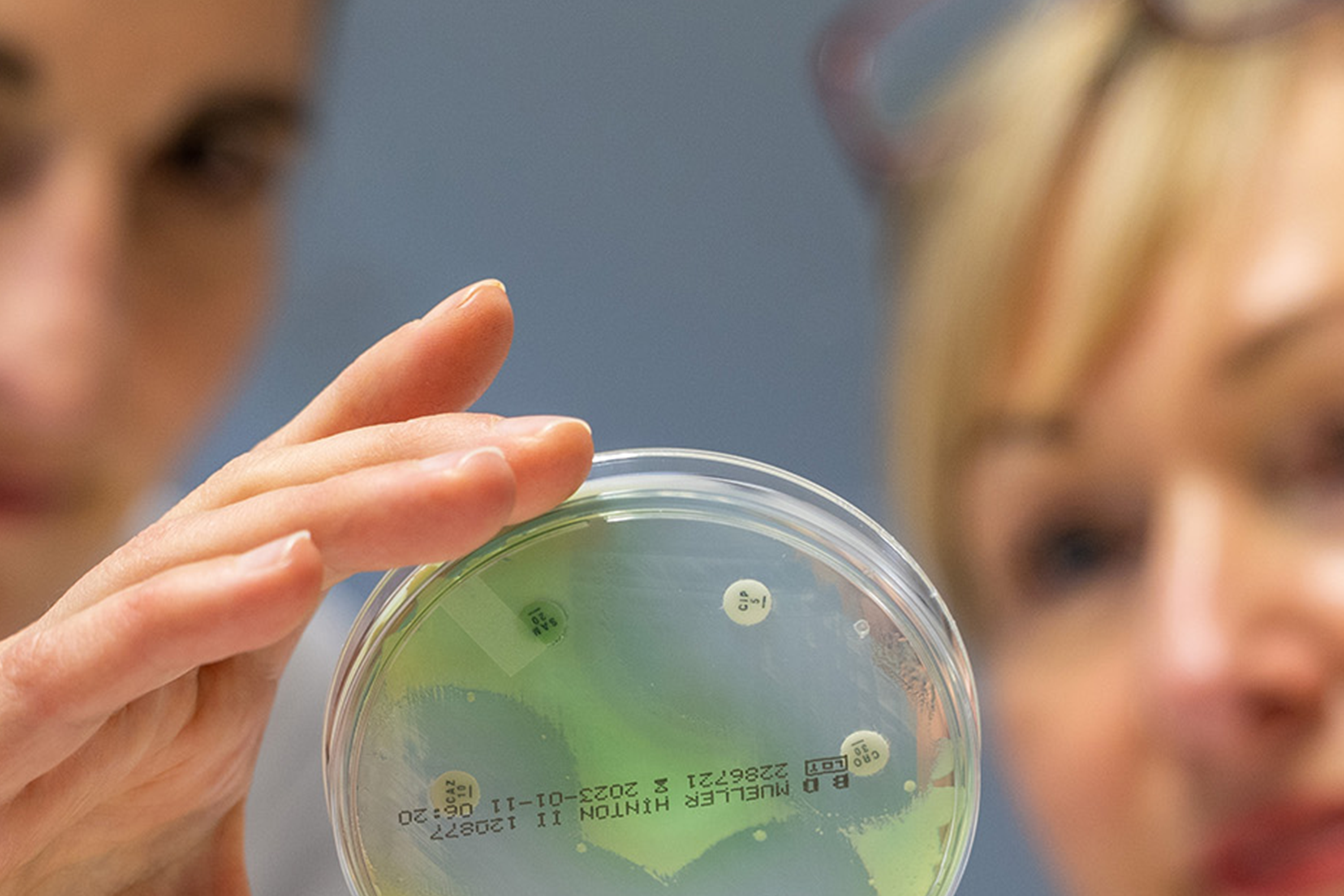 Person hält eine Petrischale mit grünen und weißen Bakterienkulturen zur Umgebungsuntersuchung belebter und unbelebter Oberflächen