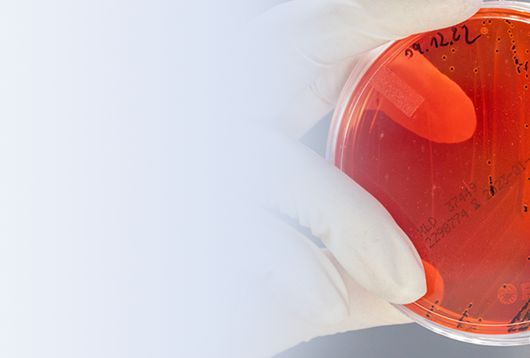 Eine Hand mit einem weißen Handschuh hält eine Petrischale mit rotem Agar. 