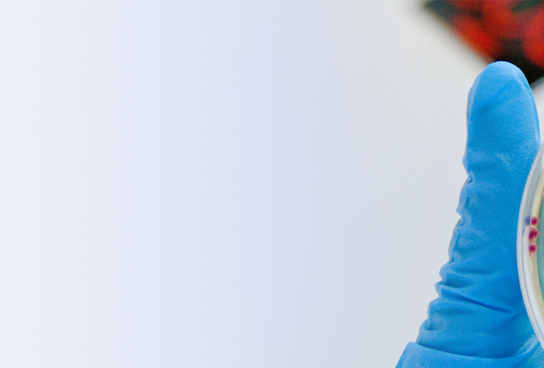 Hand mit blauer Schutzhandschuh hält Petrischale mit Bakterienkulturen zur Überprüfung der Raumluft