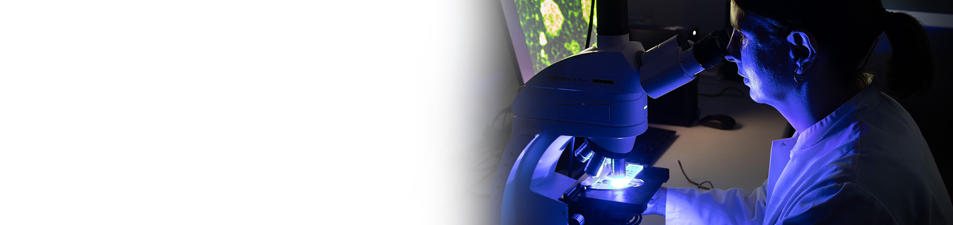 Lyme Borreliose Fleximage (10)