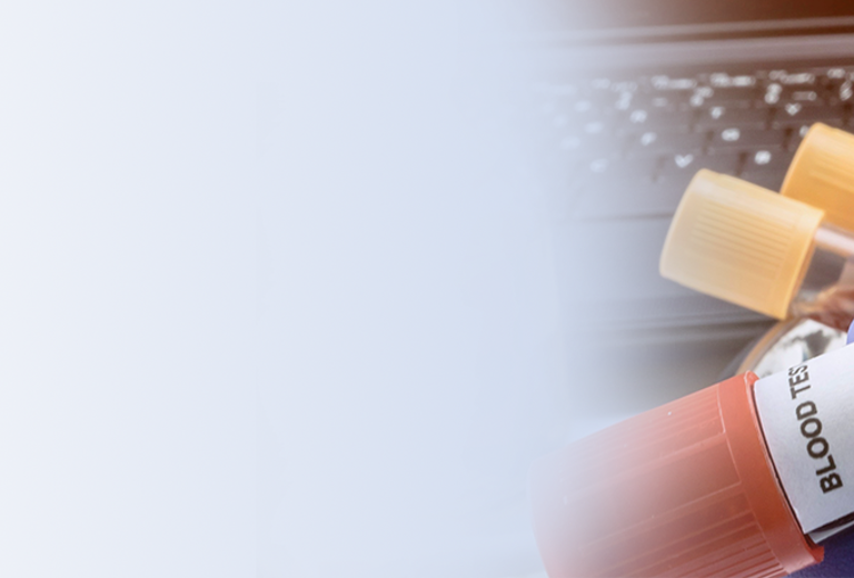 Eine Hand mit blauen Handschuhen hält ein Reagenzglas mit der Aufschrift 'ALZHEIMER'S DISEASE'. Im Hintergrund sind Labortests und ein Laptop sichtbar.