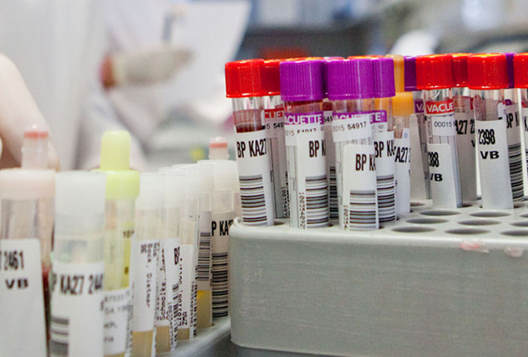 Eine Hand in einem weißen Laborkittel greift nach einem Reagenzglas mit buntem Verschluss in einem Labor mit mehreren Probenröhrchen.