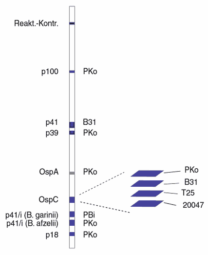 Infografik zur Borrelien-Blot-Analyse mit vertikalen Balken in Blau und Weiß, die verschiedene Proteine darstellen. Beschriftungen: p100, p41, p39, OspA, OspC, p18, PKo, B31, PBi, T25, 20047.