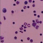 Mikroskopische Aufnahme von Zellen, die in lila und violetten Farbtönen erscheinen, auf einem rosa Hintergrund. Es sind zahlreiche runde und ovale Zellen sichtbar.