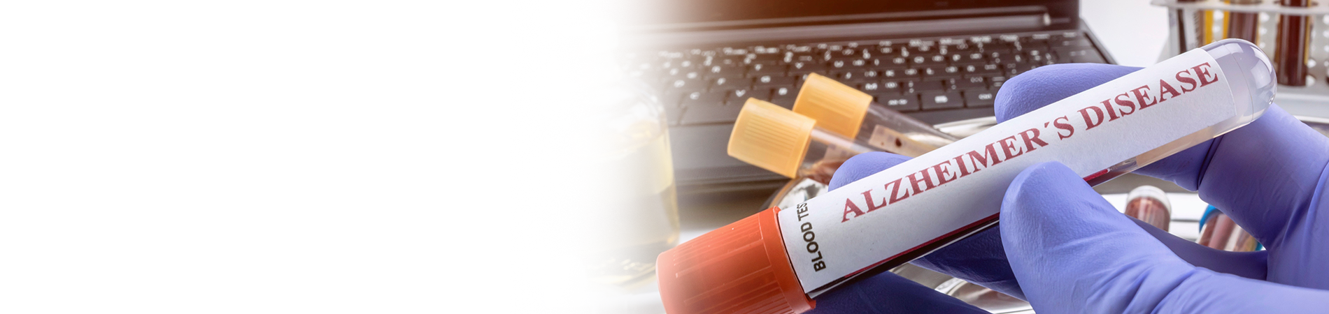 Alzheimer Fleximage