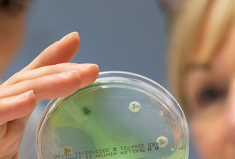 Person hält eine Petrischale mit grünen und weißen Bakterienkulturen zur Umgebungsuntersuchung belebter und unbelebter Oberflächen