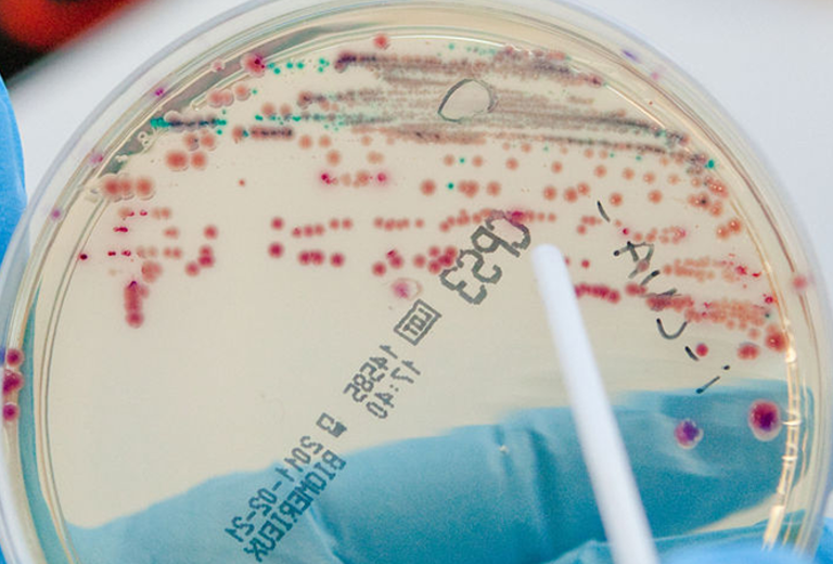 Hand mit blauer Schutzhandschuh hält Petrischale mit Bakterienkulturen zur Überprüfung der Raumluft